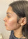 Why are acne scars red? - LEINE The Seattle Acne Clinic & Wellness Spa