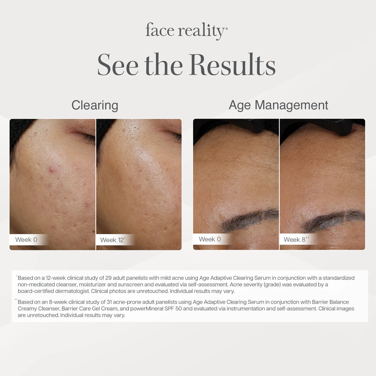 Face Reality Age Adaptive Clearing Serum - Face Reality