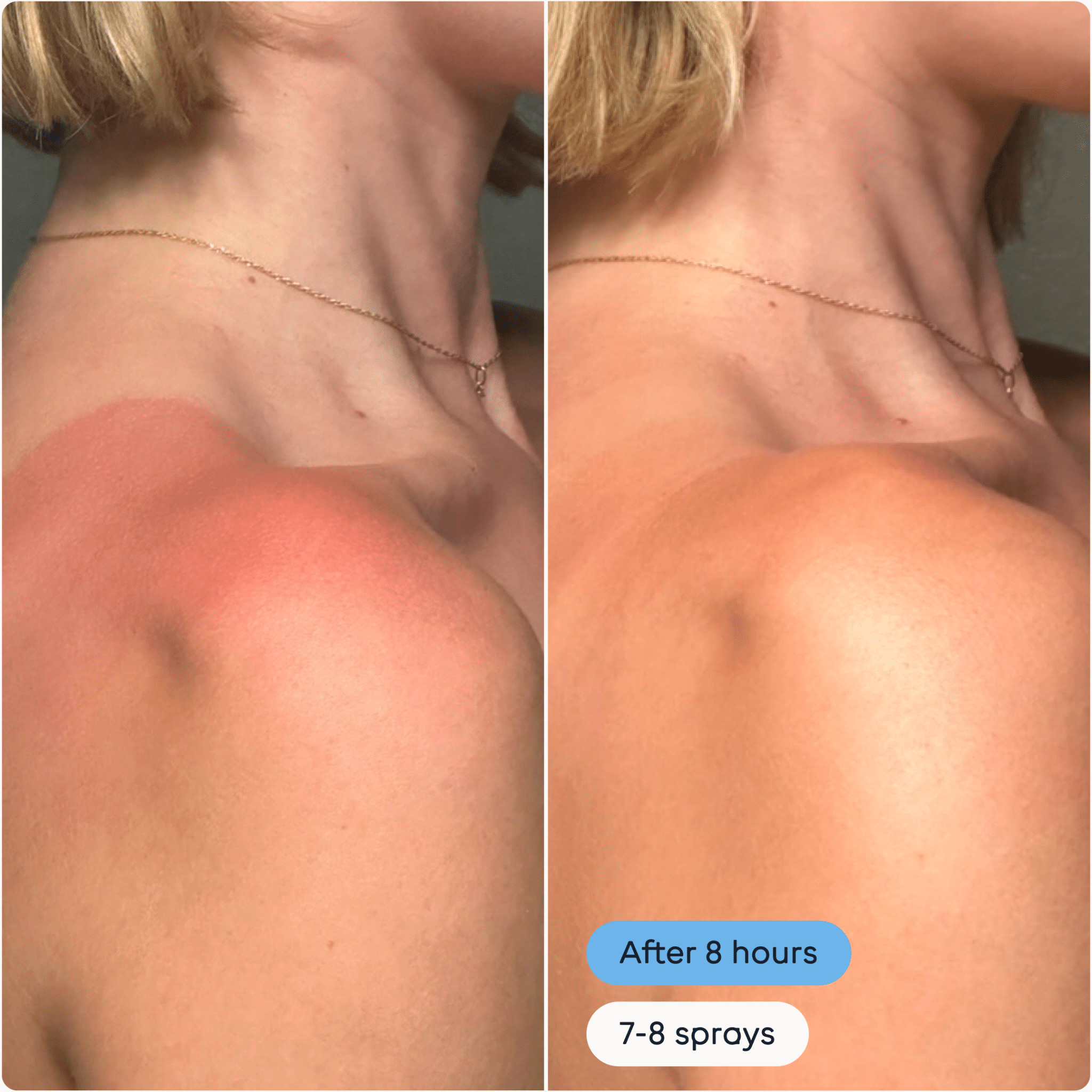 Magic Molecule Daily Skin Spray Hypochlorous Acid Spray - LEINE The Seattle Acne Clinic & Wellness SpaMagic Molecule