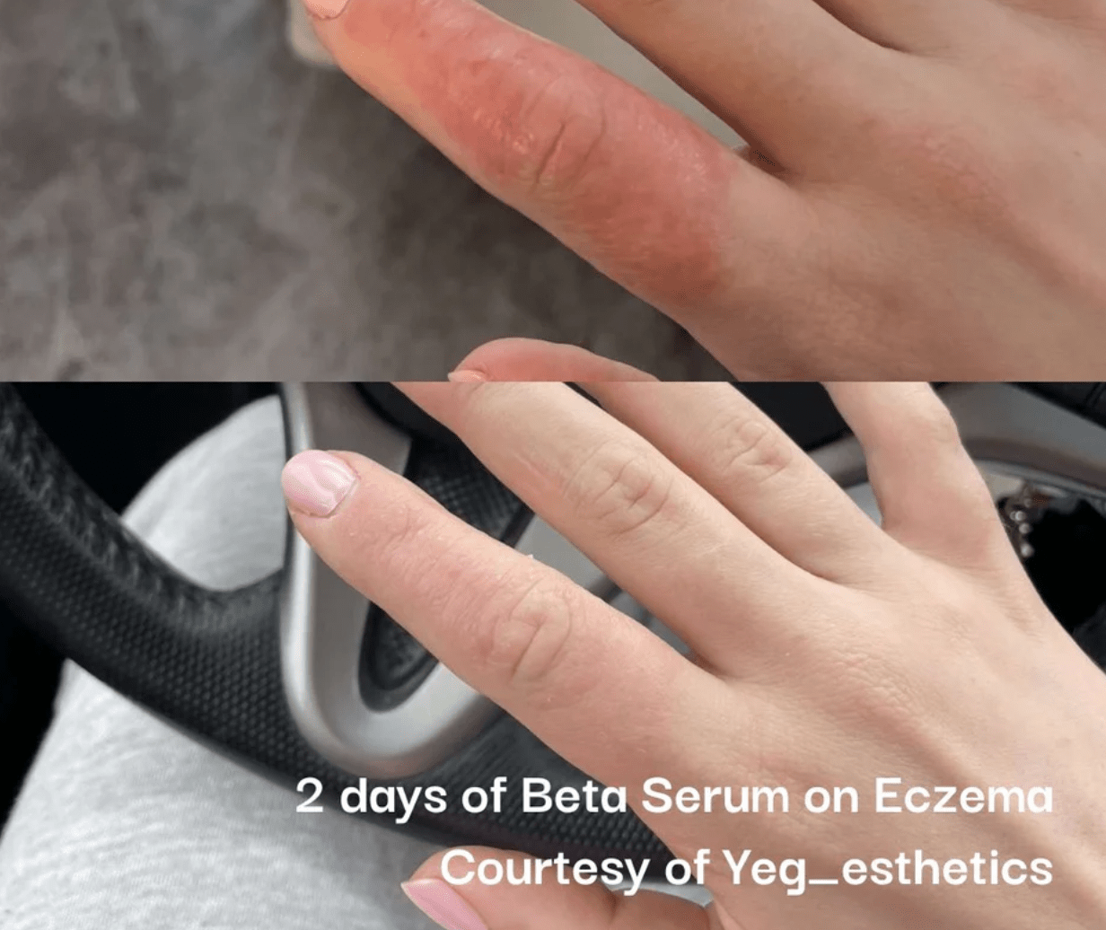 Neogenesis Beta - Glucan Serum - Neogenesis - Neogenesis