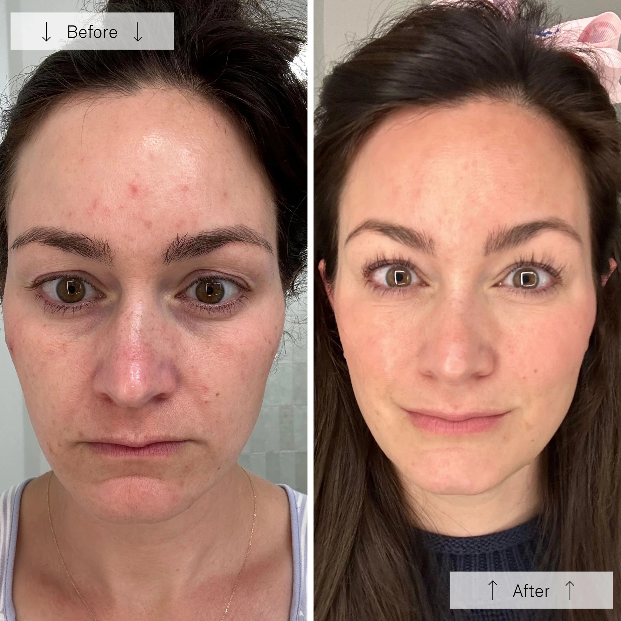 Omnilux Contour Face | Red Light Therapy Mask - Omnilux - Omnilux