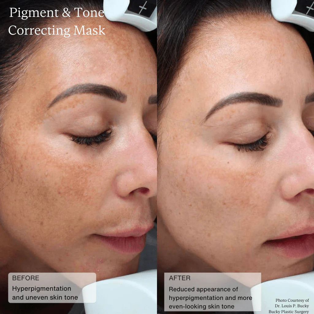 Sente Pigment & Tone Correcting Mask