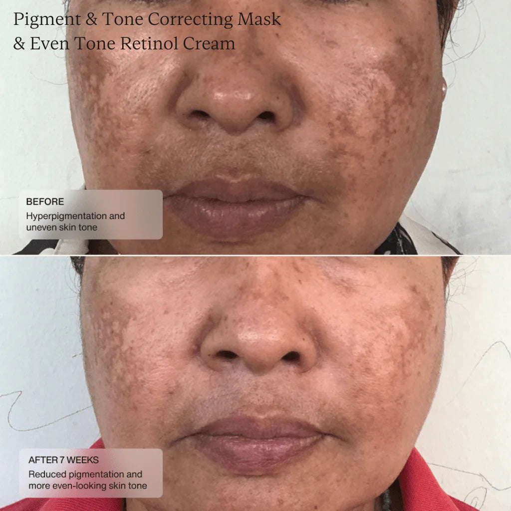 Sente Pigment & Tone Correcting Mask