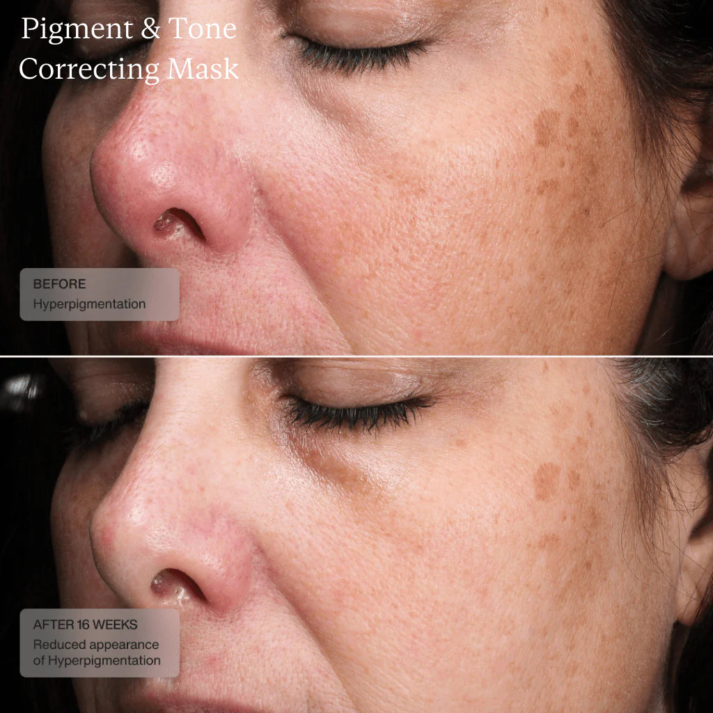 Sente Pigment & Tone Correcting Mask