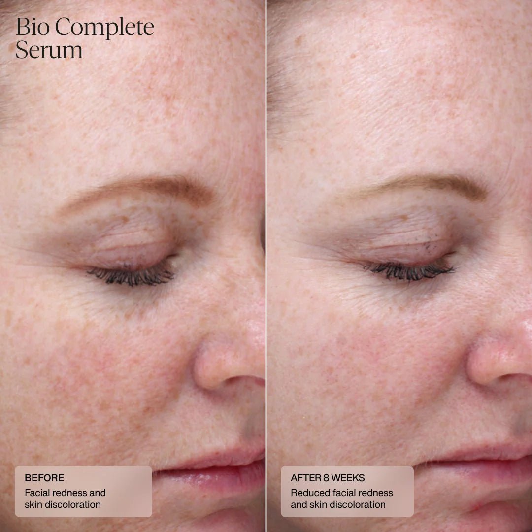 Sente Bio Complete Serum - Sente - LEINE The Seattle Acne Clinic & Wellness Spa