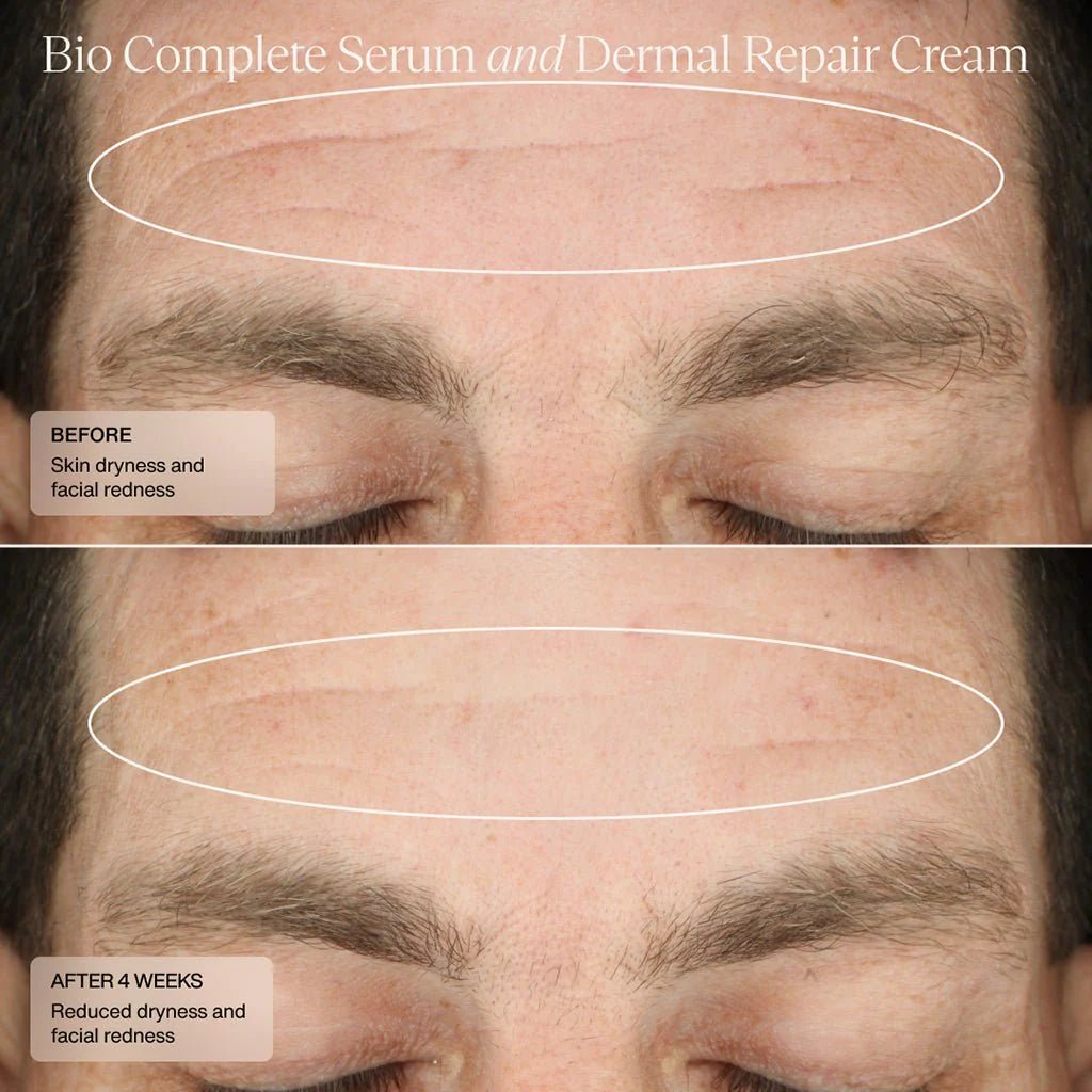 Sente Bio Complete Serum - Sente - LEINE The Seattle Acne Clinic & Wellness Spa
