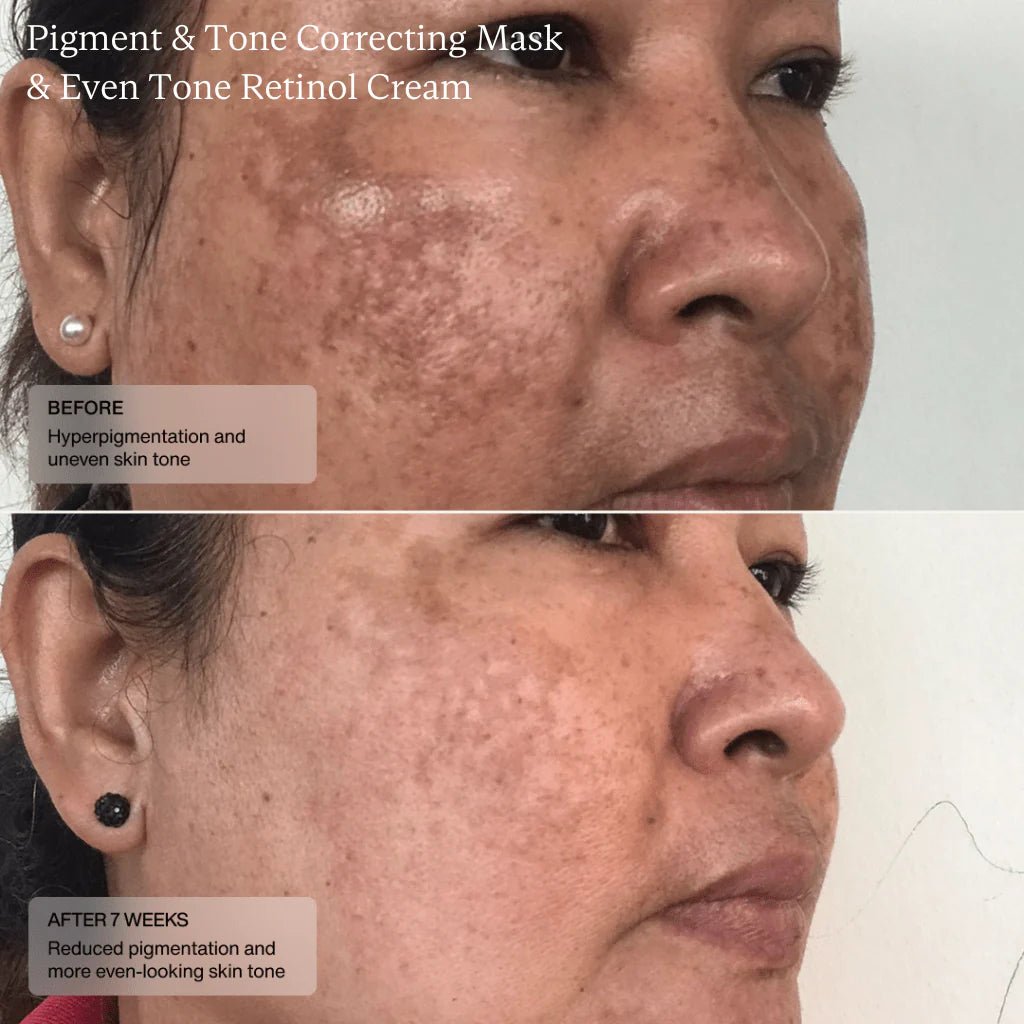 Sente Pigment & Tone Correcting Mask-Sente-Sente
