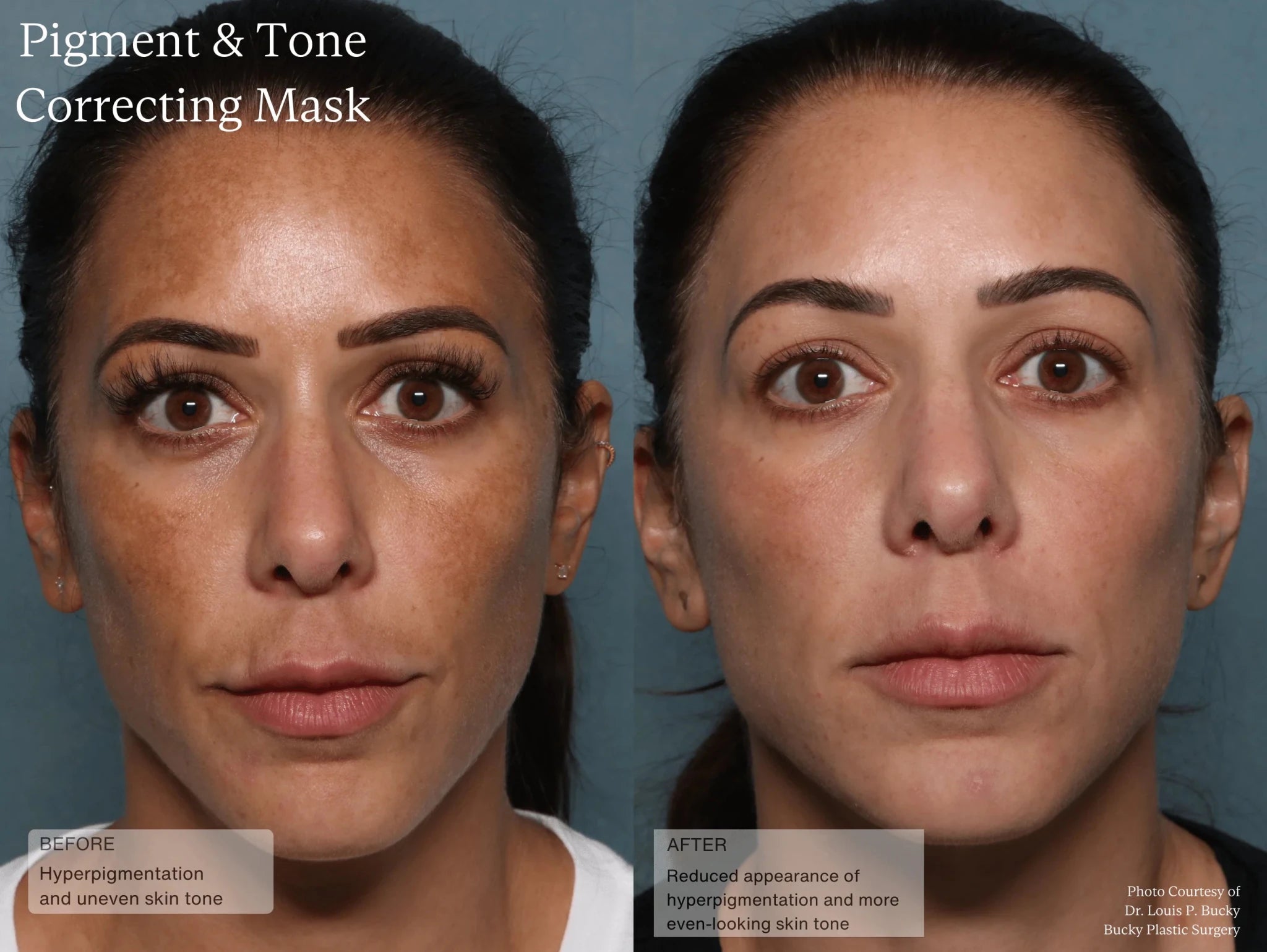 Sente Pigment & Tone Correcting Mask-Sente-Sente